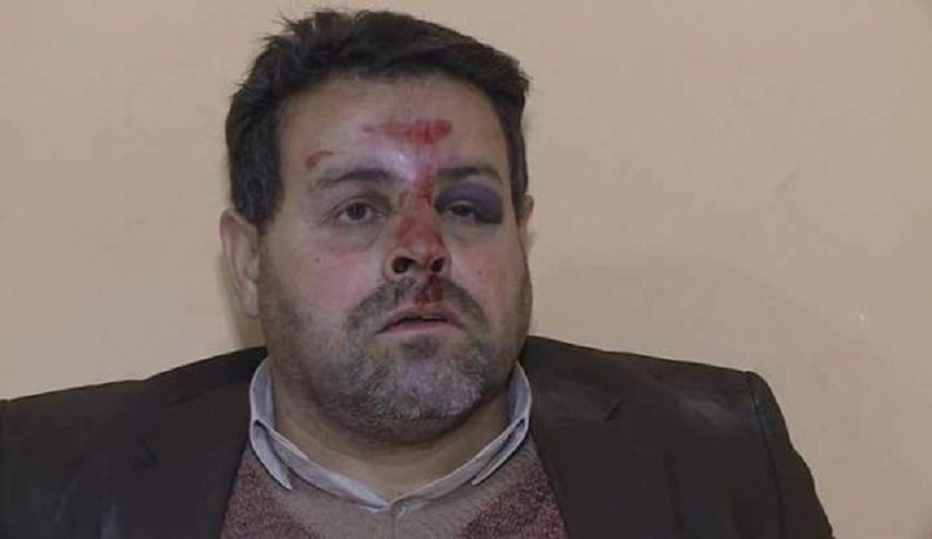  بالصورة.. والد طالب يعتدي بالضرب على معلم مدرسة في اربيل