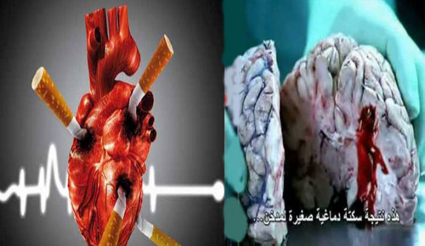  هذا ما تفعله سيجارة واحدة فقط يوميًا في قلبك! 