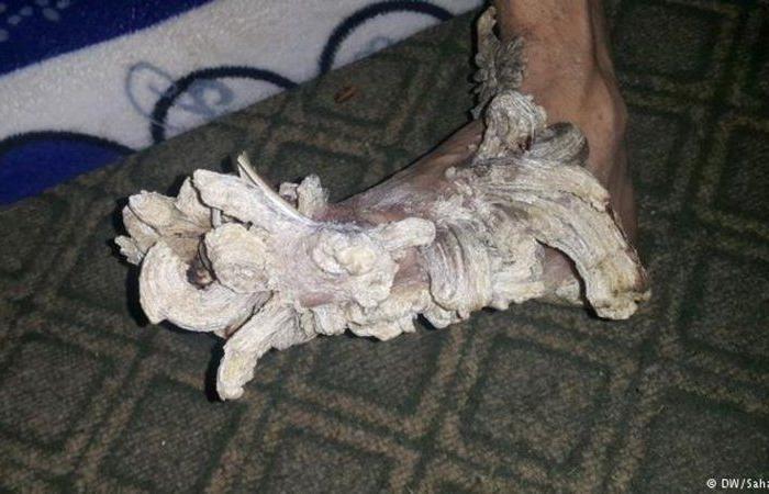 صور: عراقي يتحول إلى "شجرة" .. وهذا هو السر!