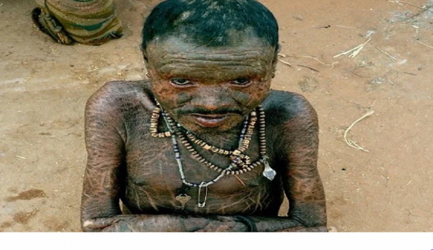  شاهد... رجل يبدل جلده كالأفعى!