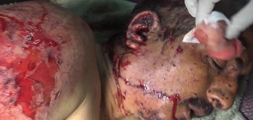 في نهم.. غارة العدوان السعودي تبدل مراسم زفاف عرس الى عزاء