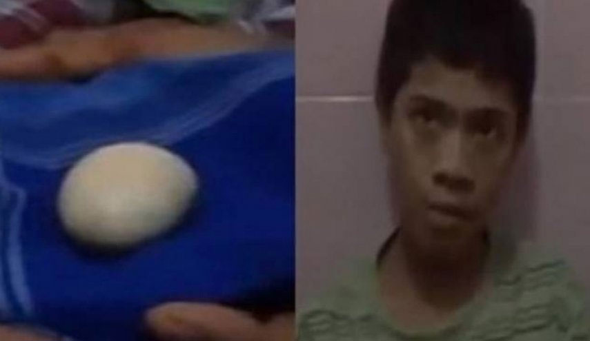 بالصور.. في ظاهرة عجيبة فتى يبيض مثل الدجاجة!