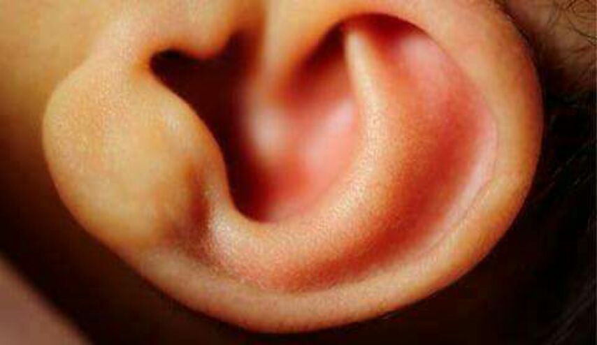 ما الحكمة في أن ماء الإذن مرّ , ماء العين مالح , وماء الفم عذب؟