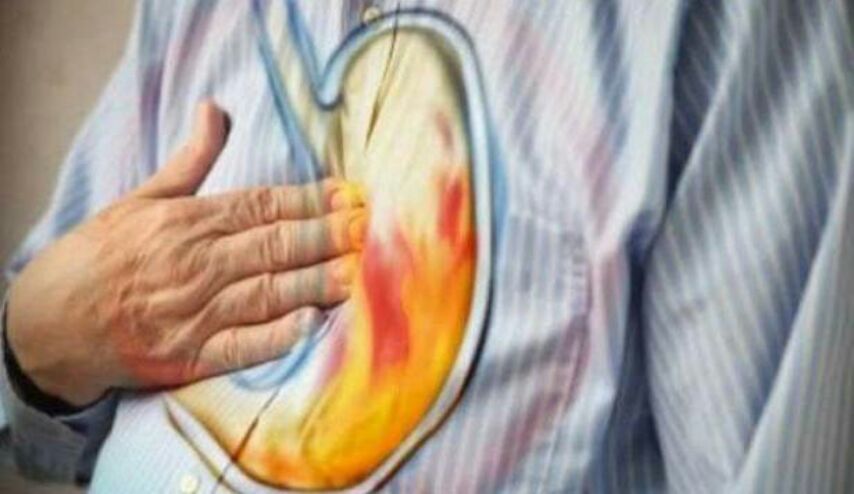 كيف توقفون حرقة المعدة في بضع ثوانٍ بدون دواء