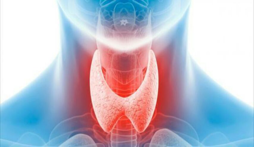 إليك العلاج الأنسب لاضطرابات الغدّة الدرقية!