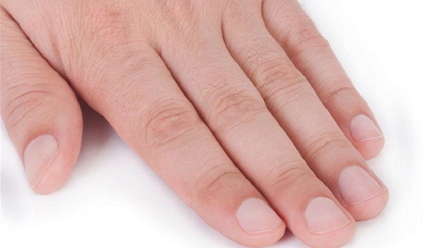 شاهد..حالة نادرة حيّرت الأطباء... ماذا نما فوق ظفر رجل؟!