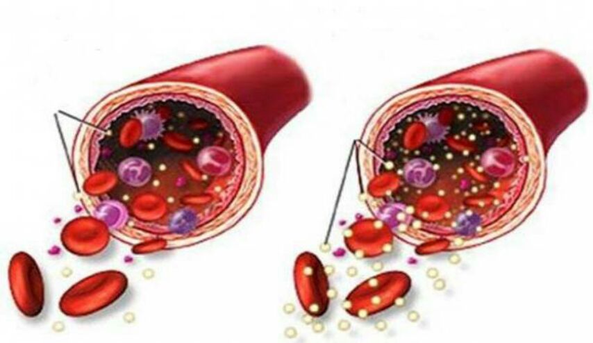 6 أطعمة تناولوها يومياً وستخفض مستوى السكر في دمكم فوراً !