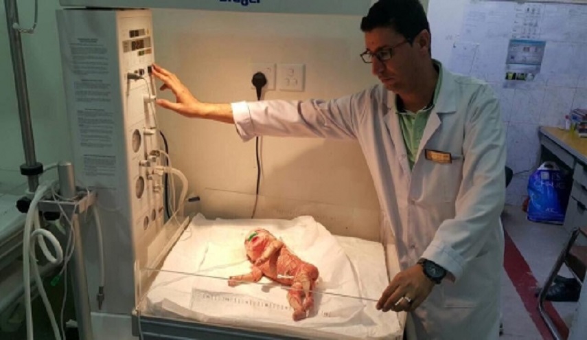 شاهد.. ولادة طفل غريب في المثنى