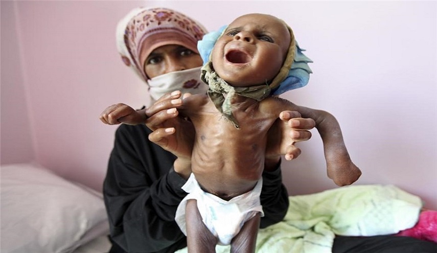 نيويورك تايمز: هكذا أصبح الوضع الإنساني باليمن كابوسا