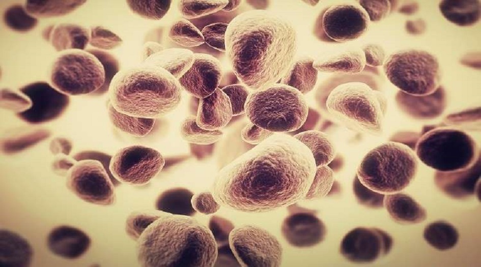 سلك مغناطيسي يكشف "القاتل الصامت" قبل ظهور أعراضه!