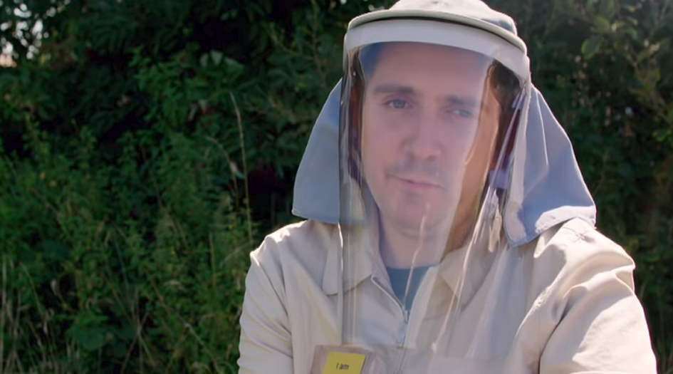 مرض نادر... شاب قد يموت إذا تعرض لضوء الشمس! (فيديو)