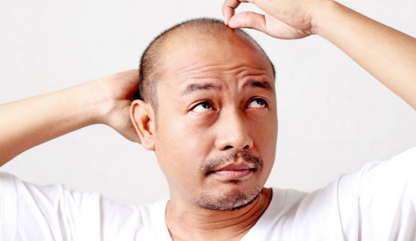 "حبة في اليوم" تقضي على الصلع والشيب