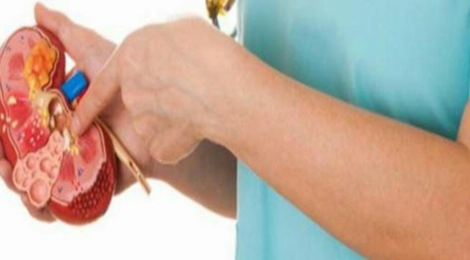 6 علامات على أنك مصاب بحصى الكلى