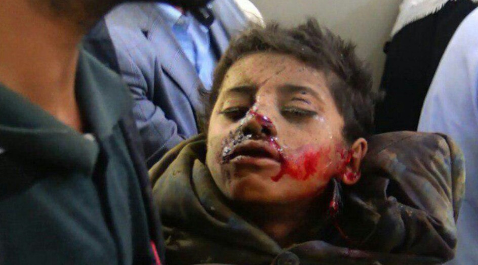 انفوجرافيك جرائم عدوان التحالف السعودي بحق الأطفال في اليمن حتى تاريخ 8 أغسطس 2018