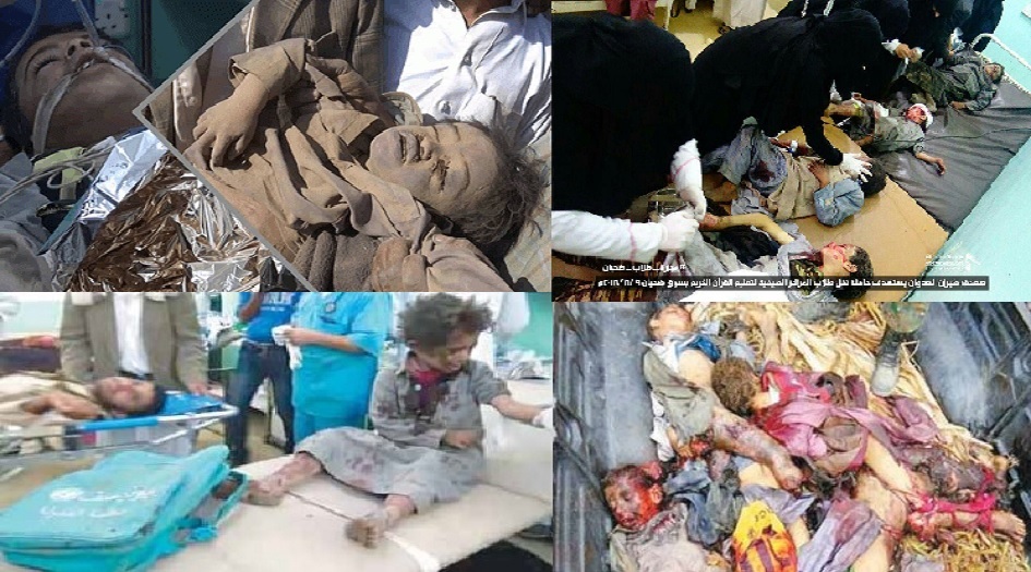 ولكن اليمن لا بواكٍ له...فأين الضمير العربي؟!