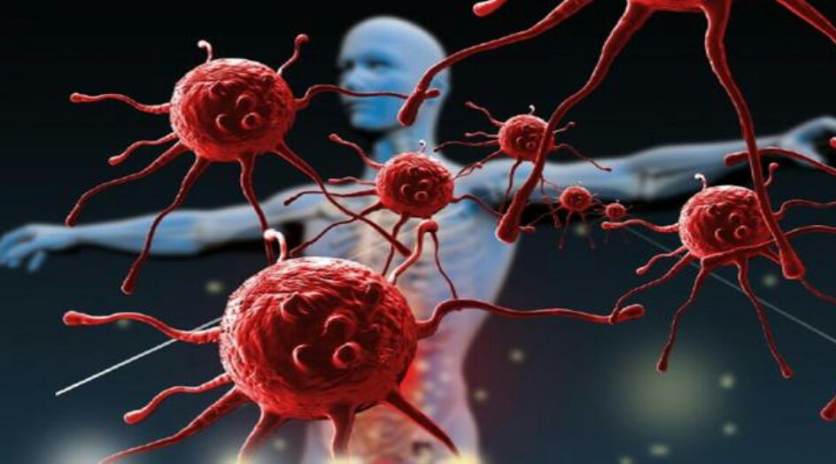 هل تعلم كيف نشأ السرطان؟