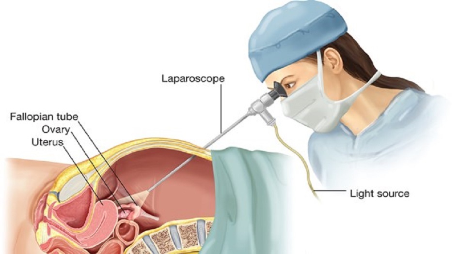 إطلاق أول جهاز وطني ايراني لتنظير البطن