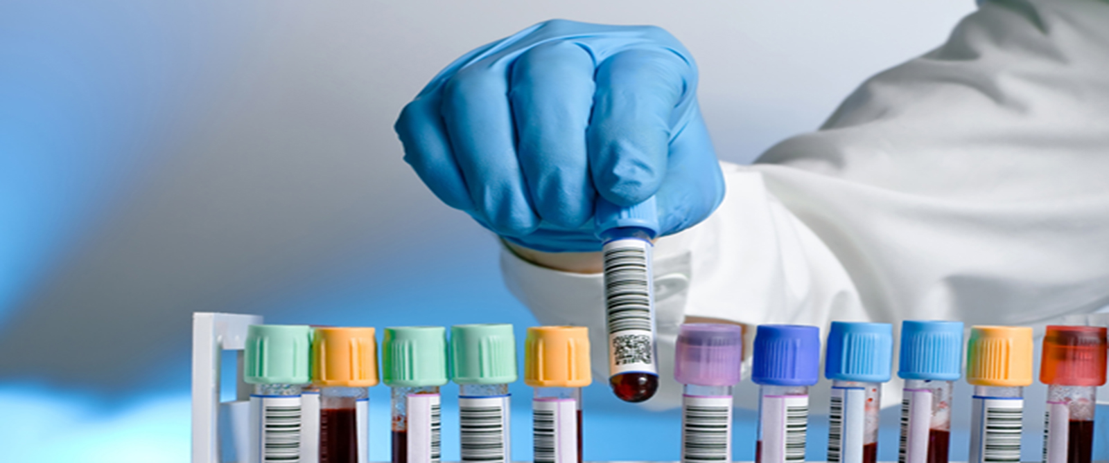 روسيا تؤكد وجود مختبرات بيولوجية أمريكية محظورة في جورجيا