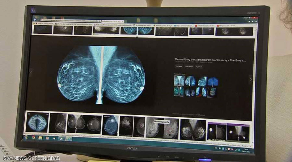 للمرة الأولى.. أول انتصار ضد سرطان الثدي