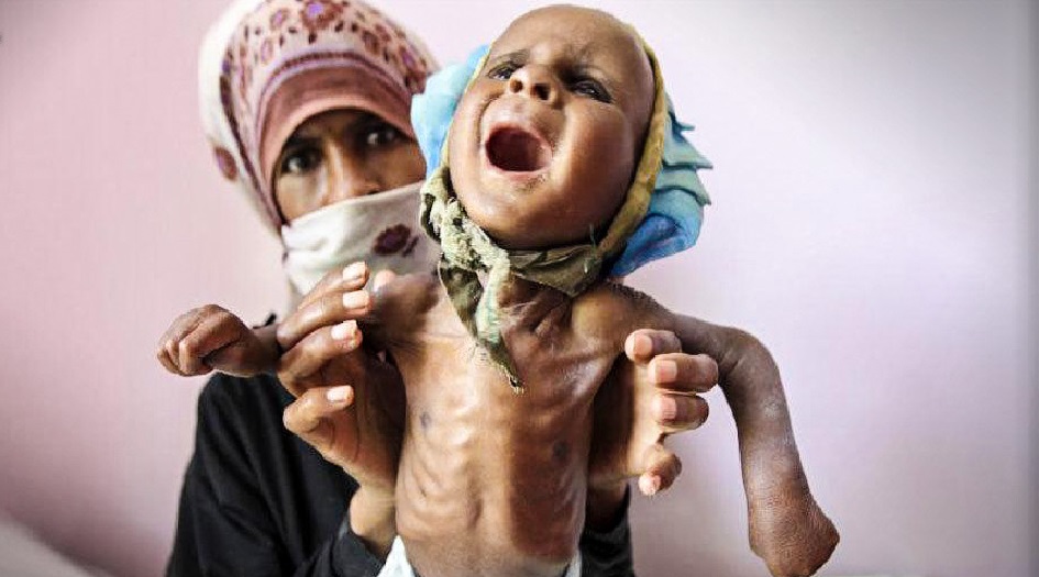 خاشقجي وأطفال اليمن .. لماذا لا يموت زعماء الغرب خجلاً؟!