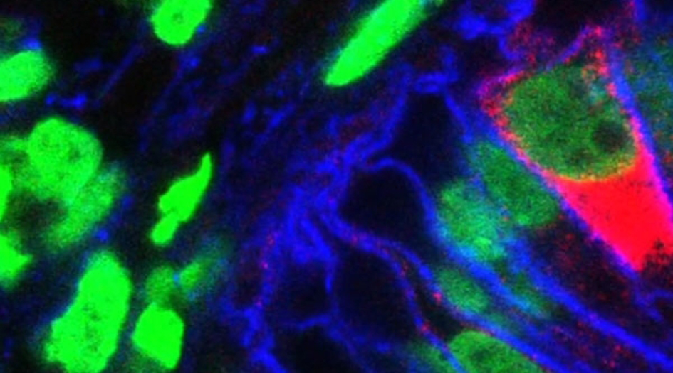 الأنسجة الصناعية في ايران تنقذ حياة المرضى