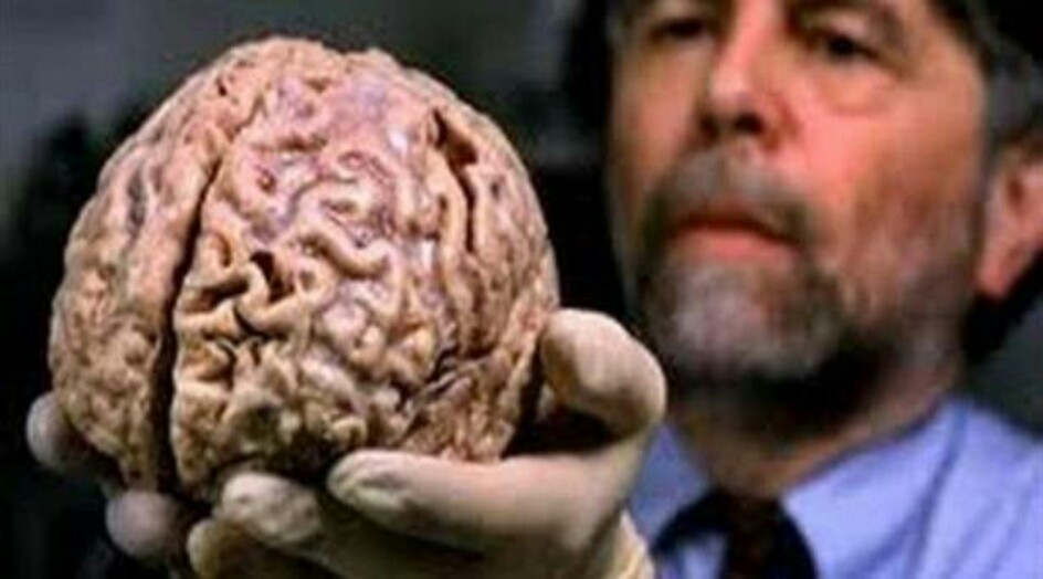 اكتشاف غامض حول الدماغ البشري.. العلماء في حيرة!