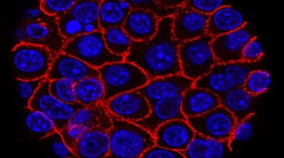  علامة مميزة لظهور السرطان