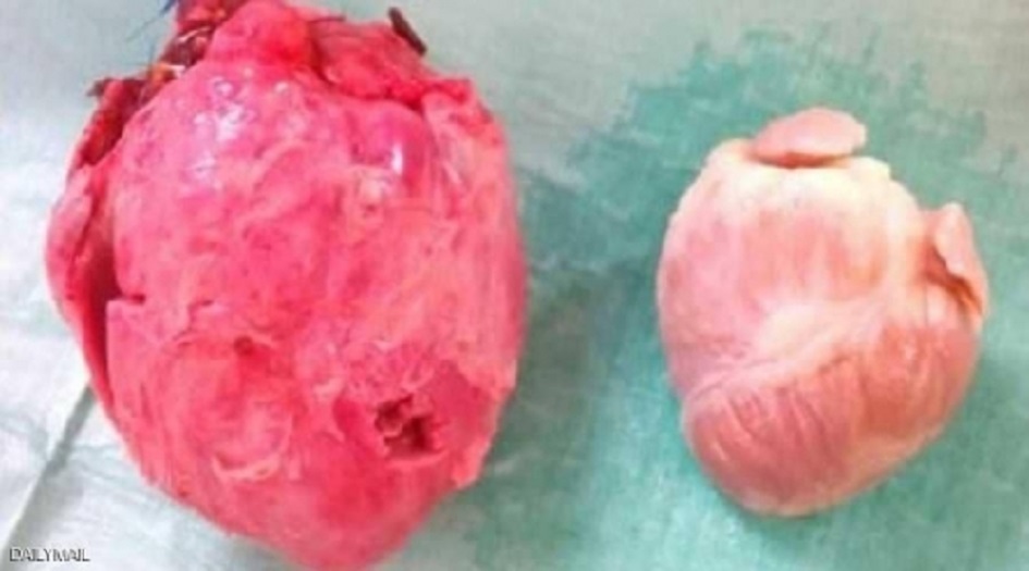 ثورة طبية على الطريق.. أعضاء الحيوانات ستنقل إلى البشر!