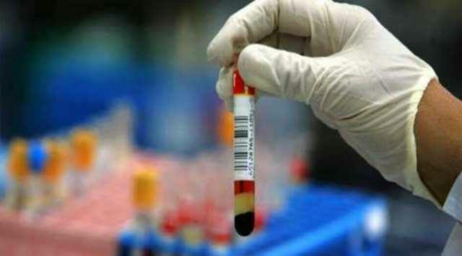 "اكتشاف ثوري" يخص مرض السرطان