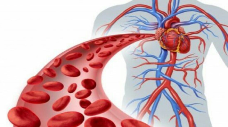 الأغذية التي توسّع الشرايين وتعالج الدوالي والجلطات والتشنجات
