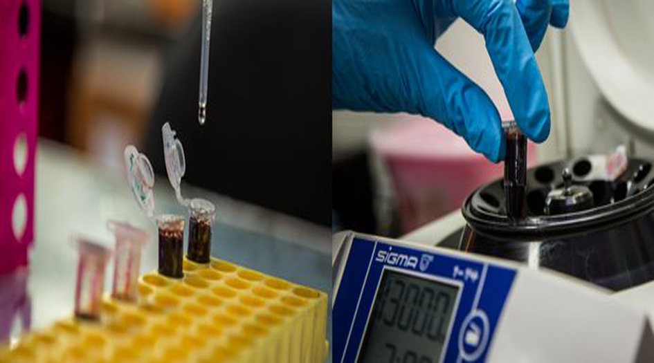 منتجات ايرانية تستخلص الـ "DNA" في نصف ساعة