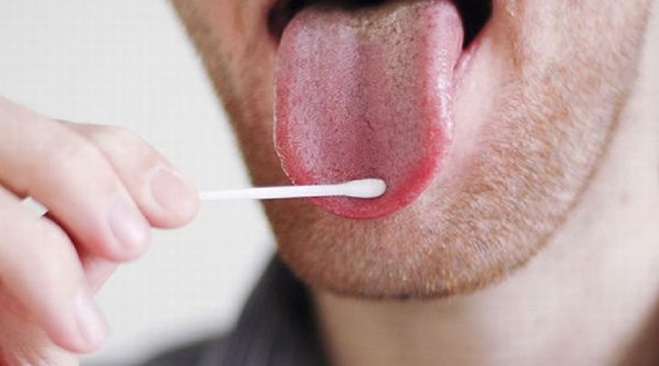  لسانك يحمل سر الإصابة بأشد الامراض فتكا