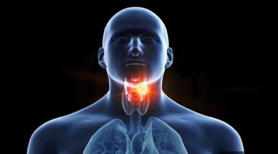 علامة مرضية تنبأ بالاصابة بسرطان الحنجرة