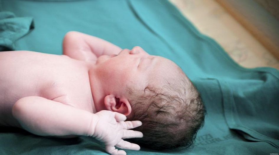 بالصورة.... "ولادة نادرة"سابقة فريدة  لم تحدث في العراق من قبل!