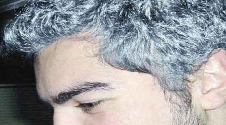 الشيب المبكر : لا تستخفوا به لهذه الأسباب !