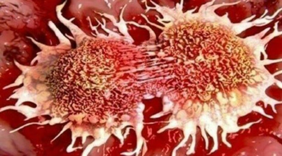 أسباب خفية للسرطان يجهلها الكثيرون!