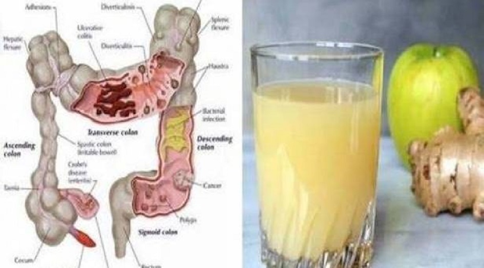 وصفات مذهلة لتنظيف الجسم من السموم!