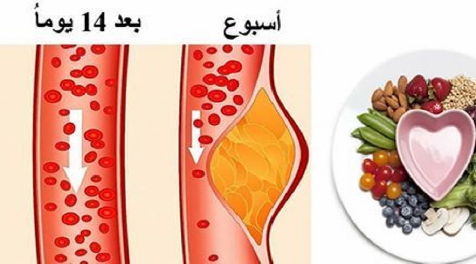 ما هو ريجيم DASH الشهير ولماذا يعتمده الأطباء حول العالم ؟