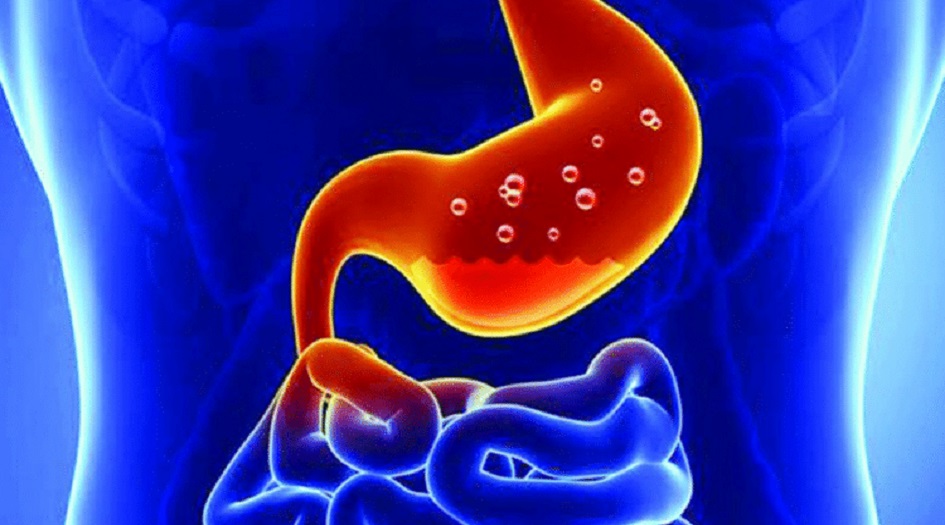 حموضة المعدة في رمضان .. خطوات ستساعدك على التخلص منها