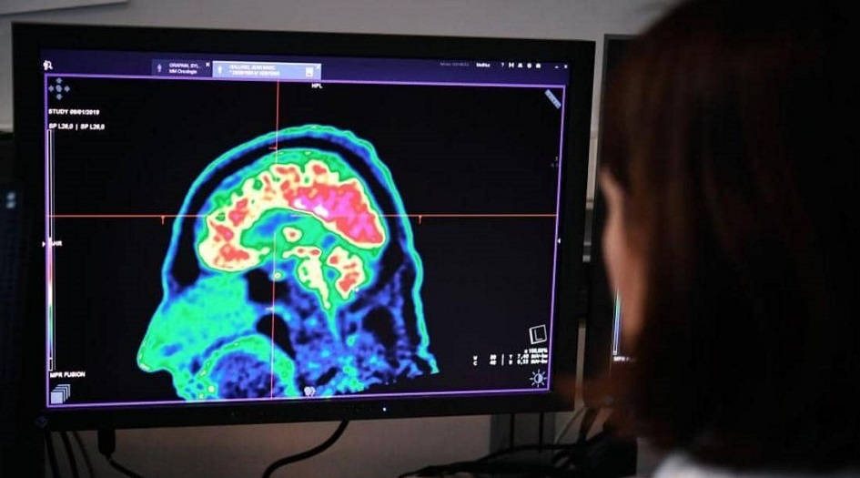 وصفة سحرية لتجنب الخرف