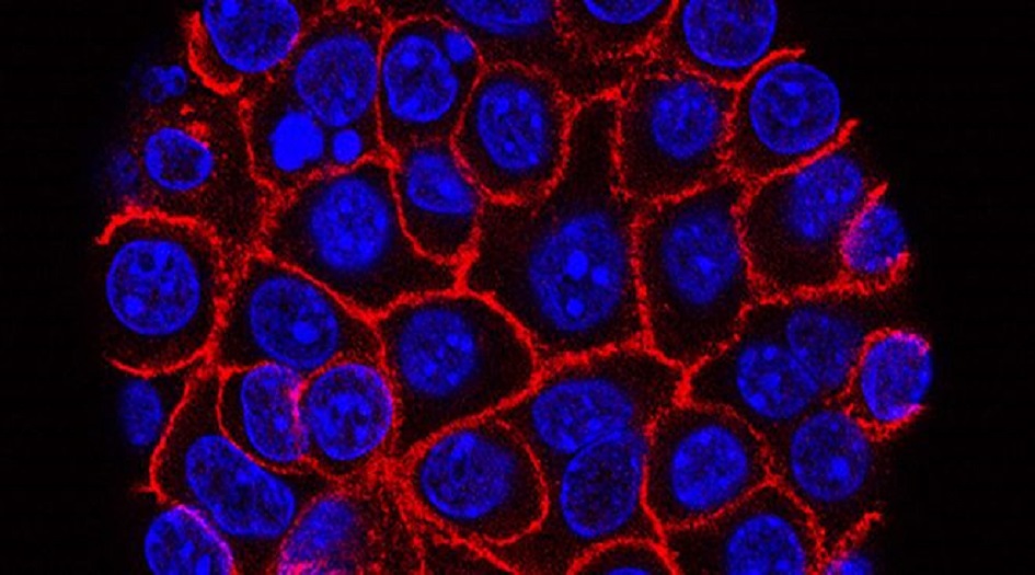 الأعراض الأولى لسرطان المعدة