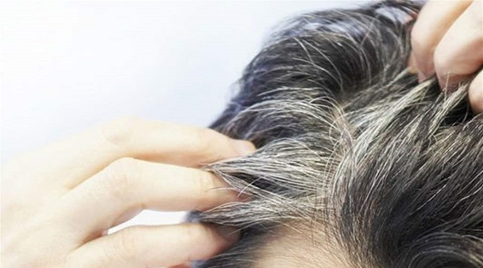 عادات خاطئة تسرع ظهور الشعر الأبيض في سن مبكر