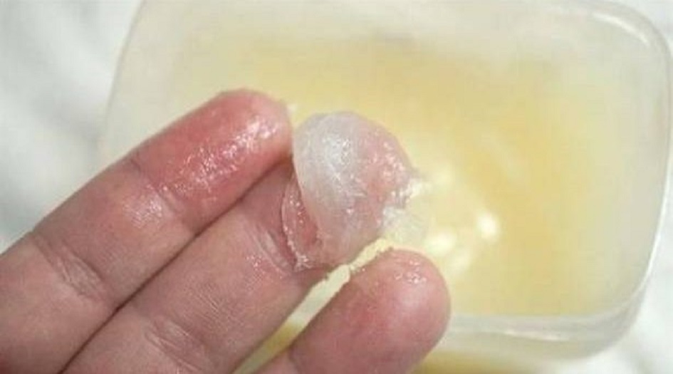 الفازلين علاج فعّال لهذا المرض..؟!