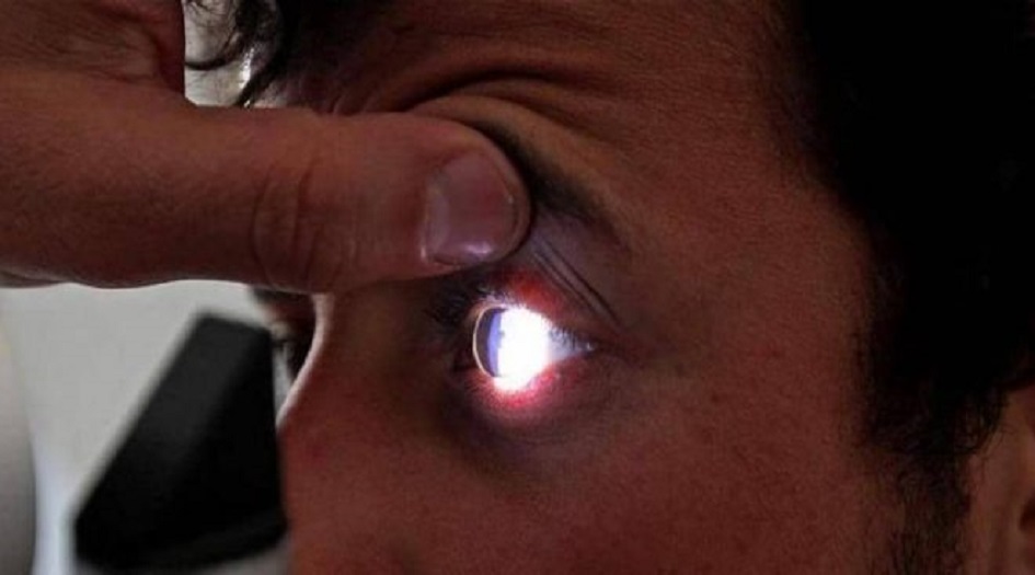 اصفرار العين.. مؤشر بسيط على أمراض خطيرة!