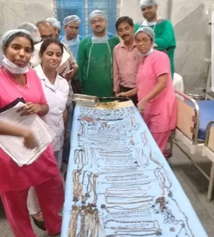 بالصور...العثور على مجوهرات بقيمة آلاف الدولارات في معدة مريضة