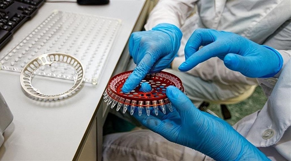 انتشار وباء جديد قاتل ..اليكم التفاصيل