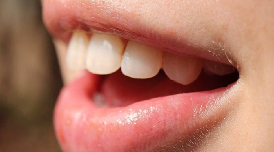 ما سبب تسمية ضرس العقل بهذا الاسم؟