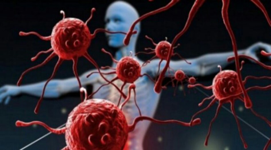 هل تخافون من السرطان ؟ كيف تميزون عوارض 4 أنواع من السرطان وحدكم