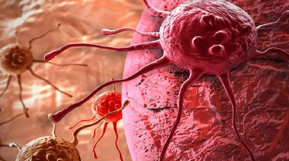 هذه الأغذية تحمي من سرطان البروستاتا !