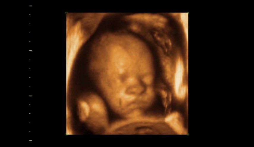 شاهد... الجنين الشيطان الذي أثار رعب والديه والعالم